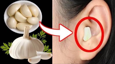 هل تعلم ما فؤاد الثوم  ؟ - أيام نيوز