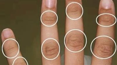 ما هي البراجم ولماذا امرنا رسول الله صل الله عليه وسلم بغسلها ؟