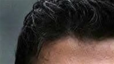 الحقيقة كاملة لفنان هيثم محمد - بطل عباس الأبيض 